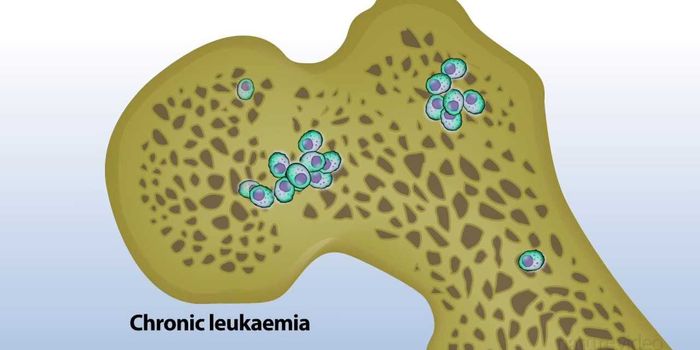 Leukaemia: When blood goes bad