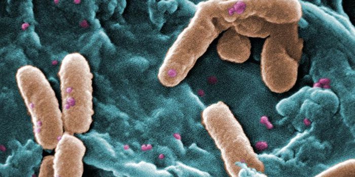 You can't kill zombies with a silver bullet, but you can create them with one.