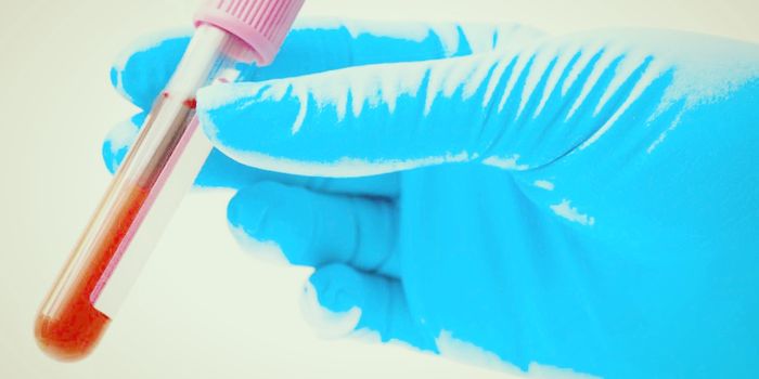 New Blood Test for 8 Cancers Works With Mixed Results