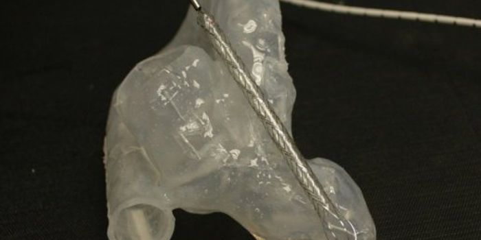 New Procedure for Post-Heart Attack Treatment Could Save Lives