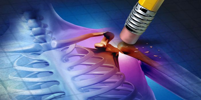 Salt-Inducible Kinase Inhibitors Reduce Inflammation