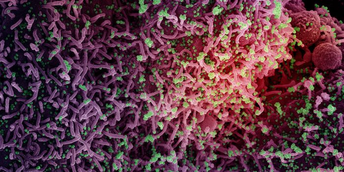 COVID-19, MIS-C & Kawasaki Disease Lead to the Same Immune Response