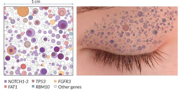 Cancer Drivers Live in Healthy Skin