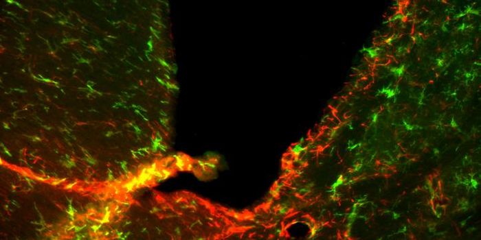 Alternative Treatments for MS Provide New Hope