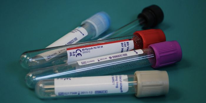 Are There Actually Five Subtypes of Alzheimer's Disease?