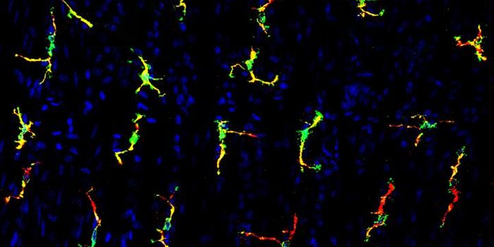 Immune Cells Responsible for Chemo-induced Diarrhea