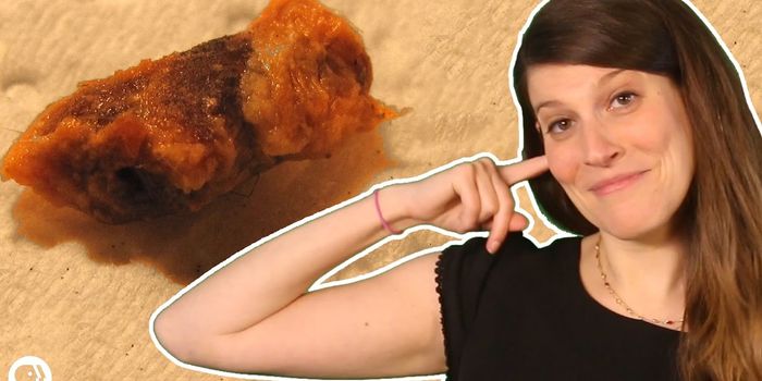 What You Earwax Says About Your Health