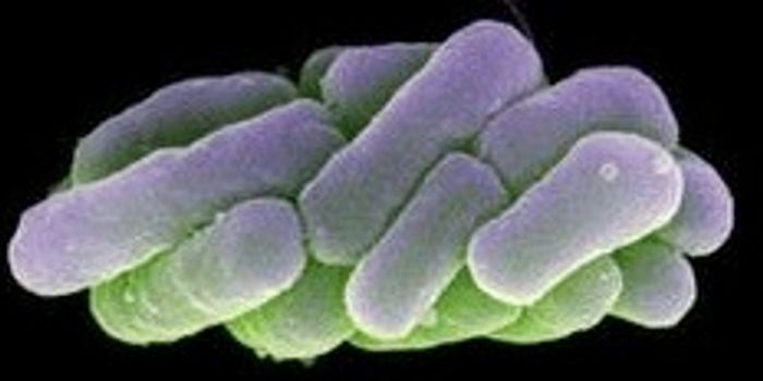 Better Know a Microbe: Chlorobium