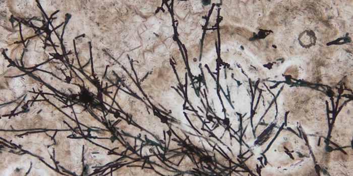 A 635-Million-Year-Old Microfungus That May Have Saved Life on Earth