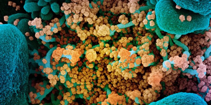 Four Major Types of Long COVID Emerge