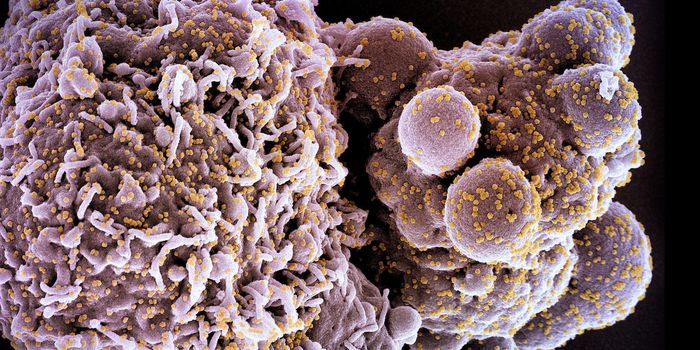 Extracts from Two Plants May Inhibit COVID-19 Infection