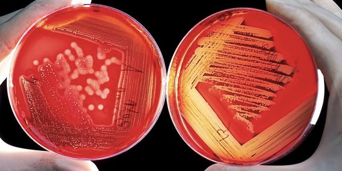 Large Studies Reveal Specific Links Between Depression & Gut Microbes