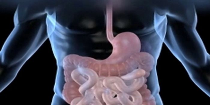 The Gut Microbiome and Stroke