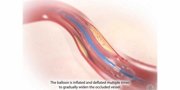 Some Heart Attack Patients Treated Faster Than Others