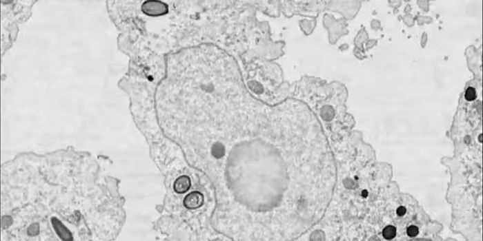 A Very Unusual Virus is Discovered in Brazil