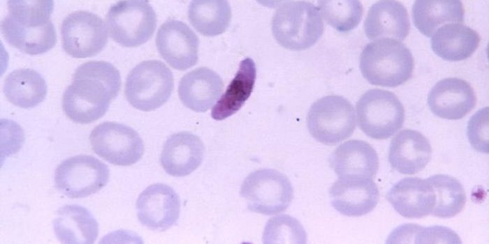 Novel Method to Suppress Malaria Parasite's Virulence Genes