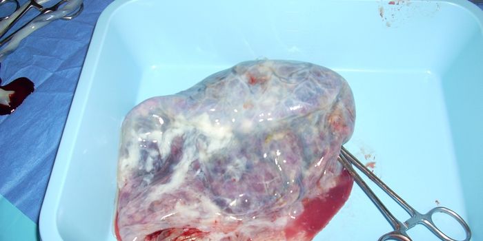 Placenta structure resembles that of tumors