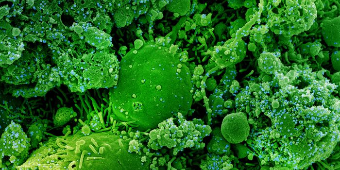 Risk of Organ Failure & Death Rises with Repeated COVID-19 Infections