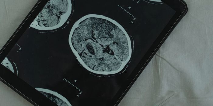 Investigating Cannabis and HIV Interactions: A $11.6M Grant Backs Weill Cornell Medicine