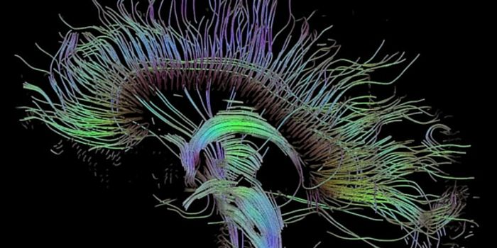 New Imaging Technology for Concussion Patients
