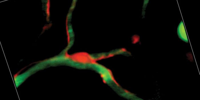 Rogue Cells Leave the BBB Defenseless During Stroke