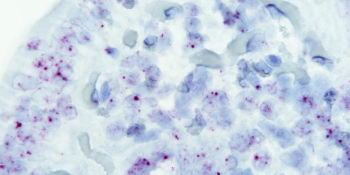 Risk Factor for Celiac Disease Found in Junk DNA