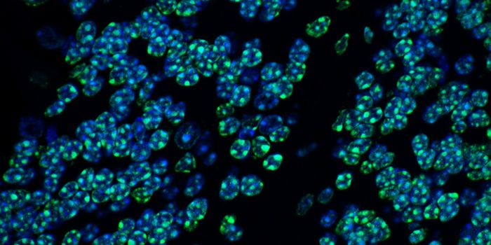 HUSH - A Complex That Silences Genes & Helps Control Brain Architecture