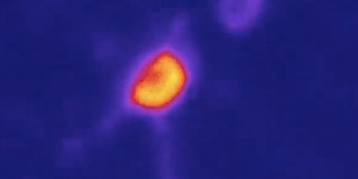 Seeing the Effect of Nicotine on Neurons