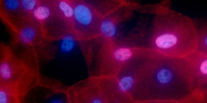 Cancer Growth Halted by Cutting Off Nutrient Supply