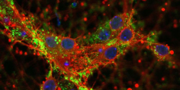 How One Protein is Linked to Three Different Brain Disorders