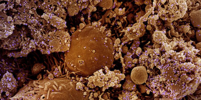 Mandated Masking & Vaccination Gets a University Back to 'Normal'