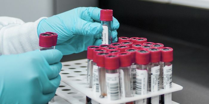 Epigenetic Changes Explain Why Childhood Trauma May Lead to Psychosis