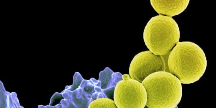 Plant Extract Takes on MRSA