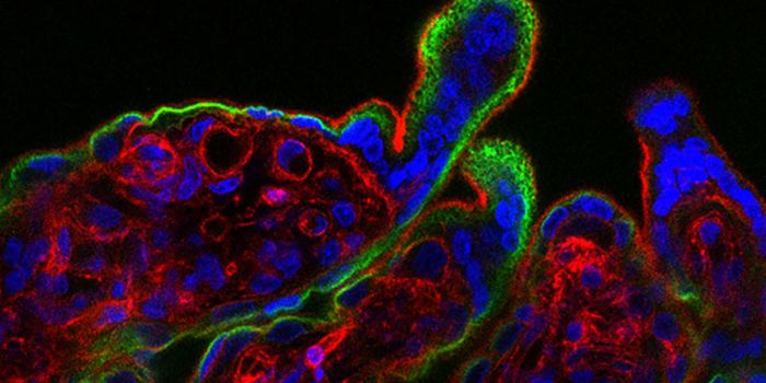 Scientists Identify Link Between Zika Virus and Pregnancy Complications