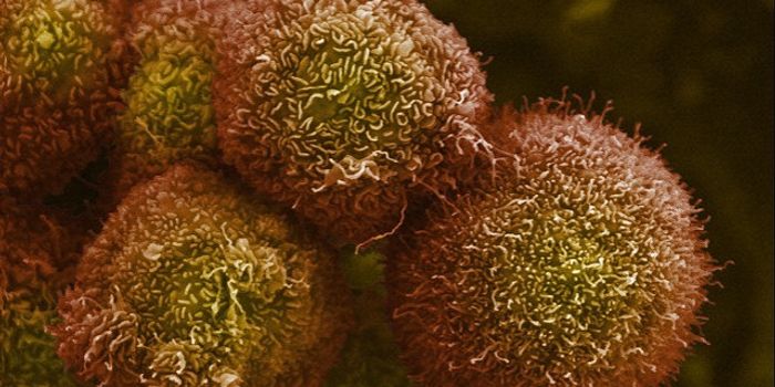 Epigenetics Initiate Pancreatic Cancer Metastasis