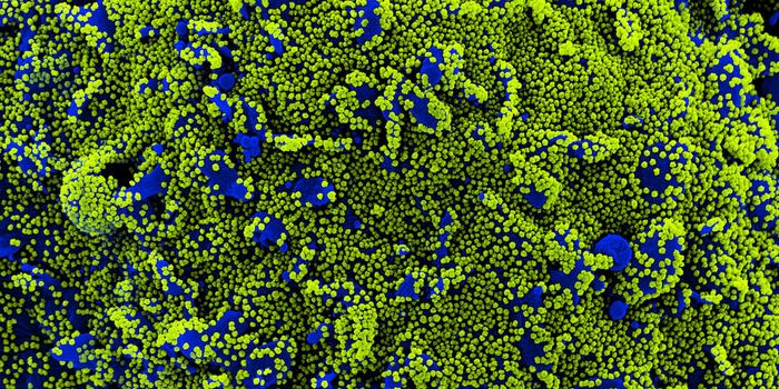 A Human Protein That Helps SARS-CoV-2 Move Through Cells