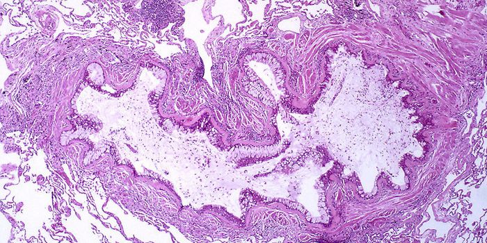 Therapeutic Antibody Inactivates Allergic Response