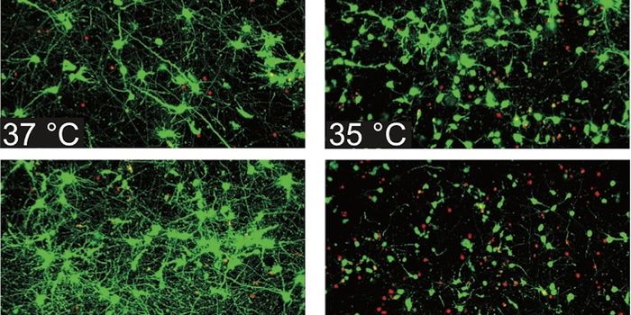 Cooling Injured Brain Cells Can Aid Recovery