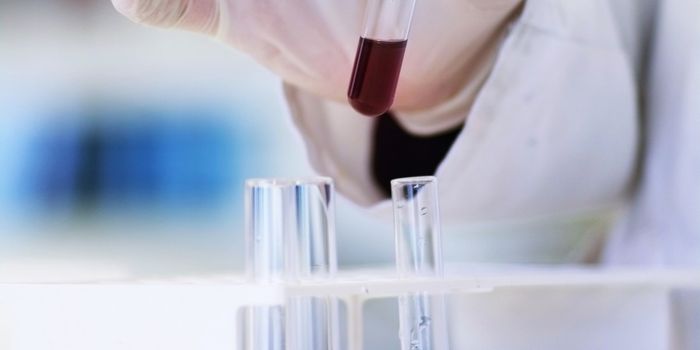 Diagnostic Tool Could ID 20% of Autism Cases