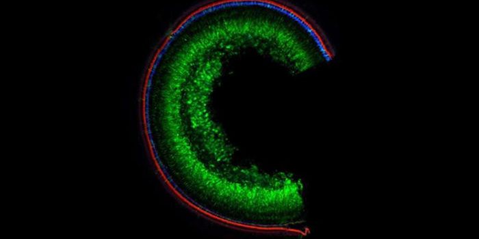 Restoring Hearing by Editing Only One Base of a Gene