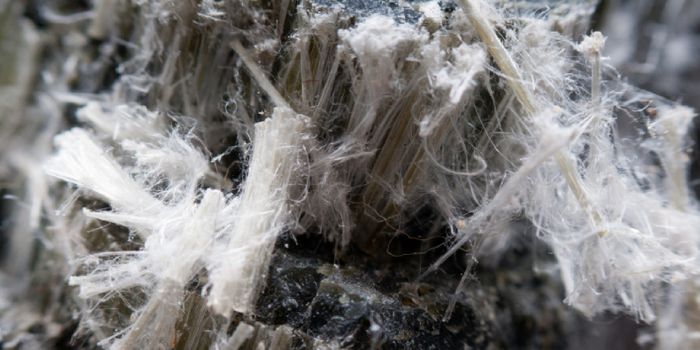 First Approved Drug to Show Promise Against Mesothelioma