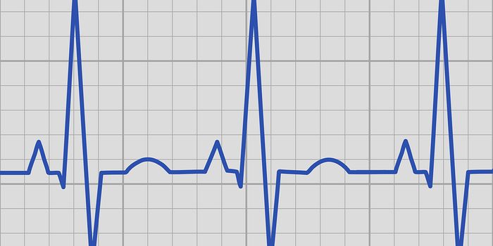 Interfering with Inflammatory Signals to Treat Arrhythmia