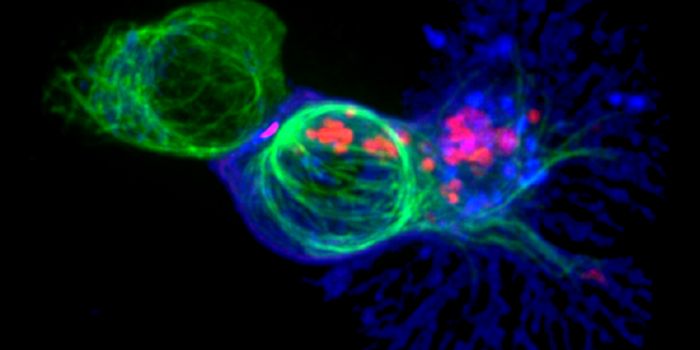 Rogue, Cancer-Linked Immune Cells Found to Drive Autoimmune Disorders