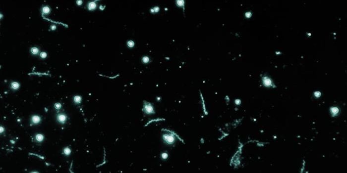 Syphilis was Spreading in Europe Before Columbus' Time