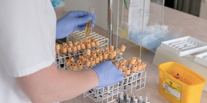 FDA to Begin Regulating Clinical Lab Tests