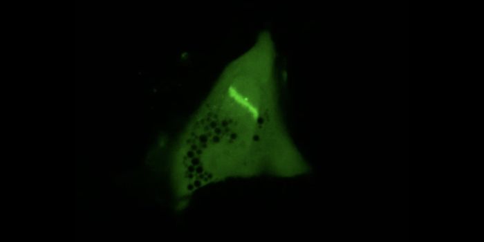 High-Throughput Tools Reveal New Proteins Involved in DNA Repair