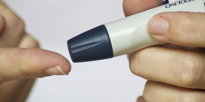 Benign Kidney Tumors Linked to Type 2 Diabetes