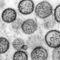 Potential Rare Human-to-Human Transmission in a Hantavirus Outbreak