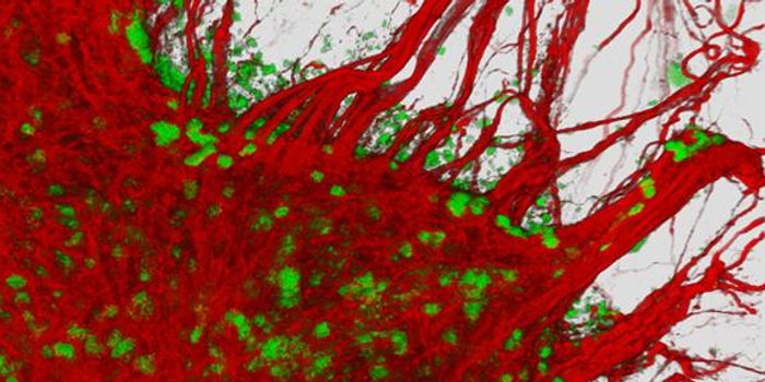 Protein Links Point to Future Alzheimer's Treatments