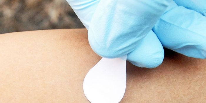 Will this microneedle patch help wipe out measles?